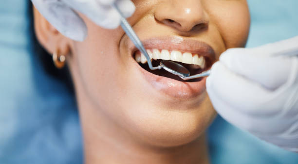 Best Emergency Dentist for Lost Fillings or Crowns in Las Lomas, TX